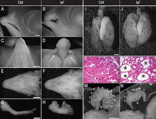 The avian mutant ta2 phenocopies human OFD. (A-H) Whole mount images of day 10 control and ta2 embryos. (A, B) Lateral view of control and ta2 face with cleft lip (B) denoted by dotted white line. (C, D) Ventral view of control and ta2 palate with cleft primary palate (D) denoted by white arrows. Compare width of naturally occurring cleft of the secondary palate in (C) and pathological cleft in (D); dotted white lines. (E, F) Dorsal view of control and ta2 mandible. (F) ta2 embryos exhibit hypoglossia (compare dotted white lines in (E) and (F)). (G, H) Lateral view of control and ta2 forelimb. (H) ta2 embryos exhibit severe polydactyly. (I, J) Whole mount image of day 13 control and ta2 kidneys with polycystic kidneys denoted by black asterisks (J). (K, L) H&E staining on day 13 control and ta2 kidneys with cysts marked with black asterisks (L). (M, N) Micro-CT images of day 13 control and ta2 cerebella with folia numbered and fourth ventricle denoted (fv).